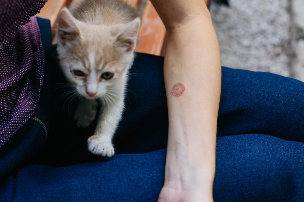 La teigne du chat peut provoquer une zoonose